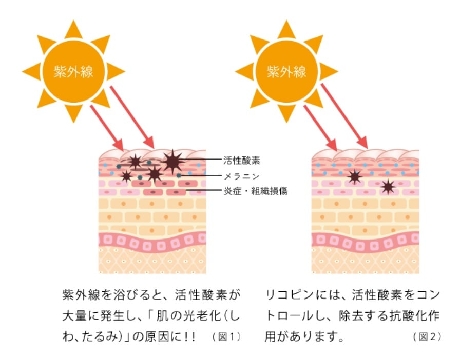 ルルーナ LYCO BARRIER」(リコバリア)4