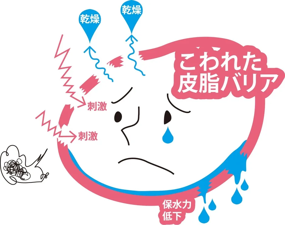 皮脂バリアが崩れた状態を示す模式図