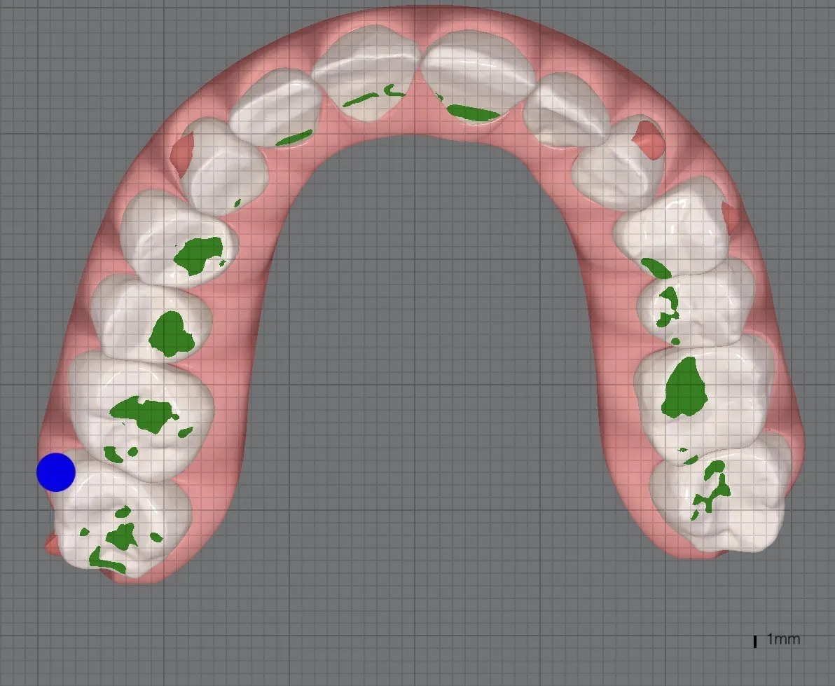 空飛ぶバイク市場の成長予測を示すレポートビジュアル