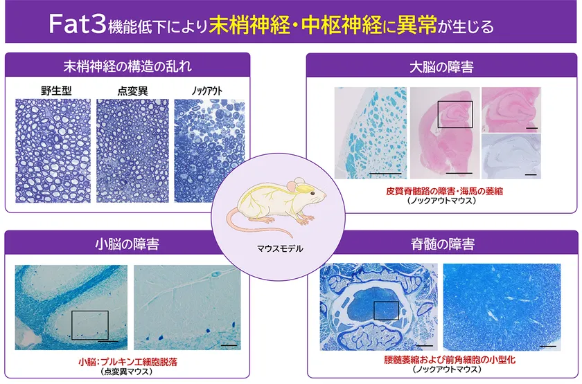 マウスモデルで末梢神経や脊髄、大脳、小脳に広範な神経障害が確認されたことを示す図