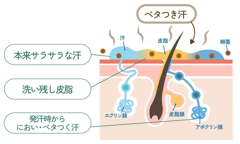 ベタつき汗の仕組み
