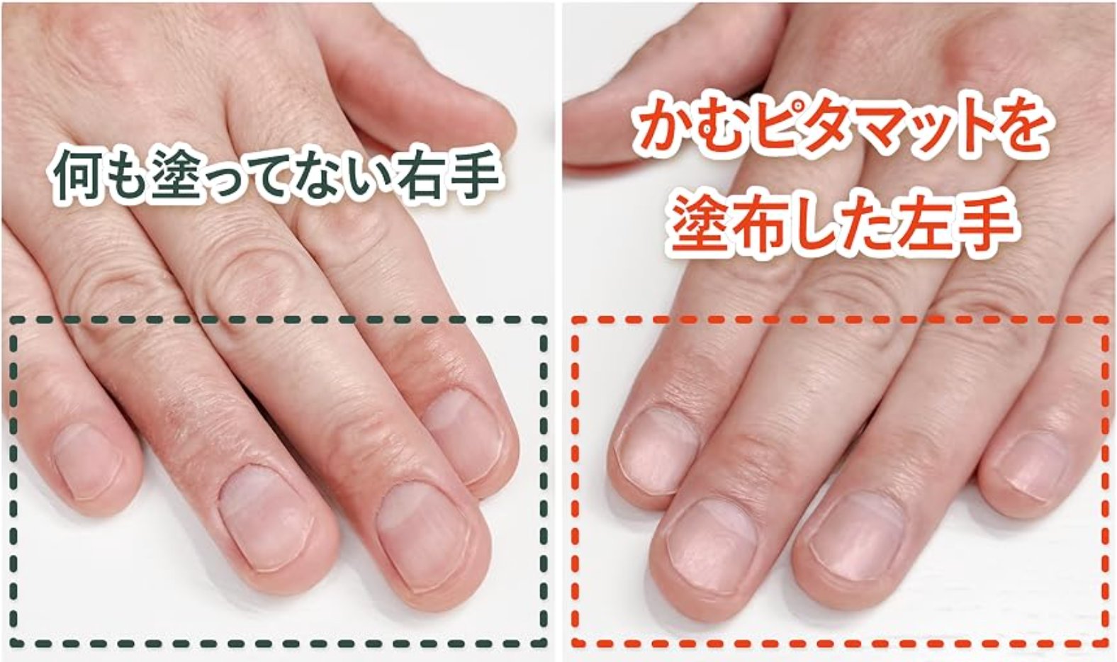 何も塗っていない爪とかむピタマットを塗った爪の比較