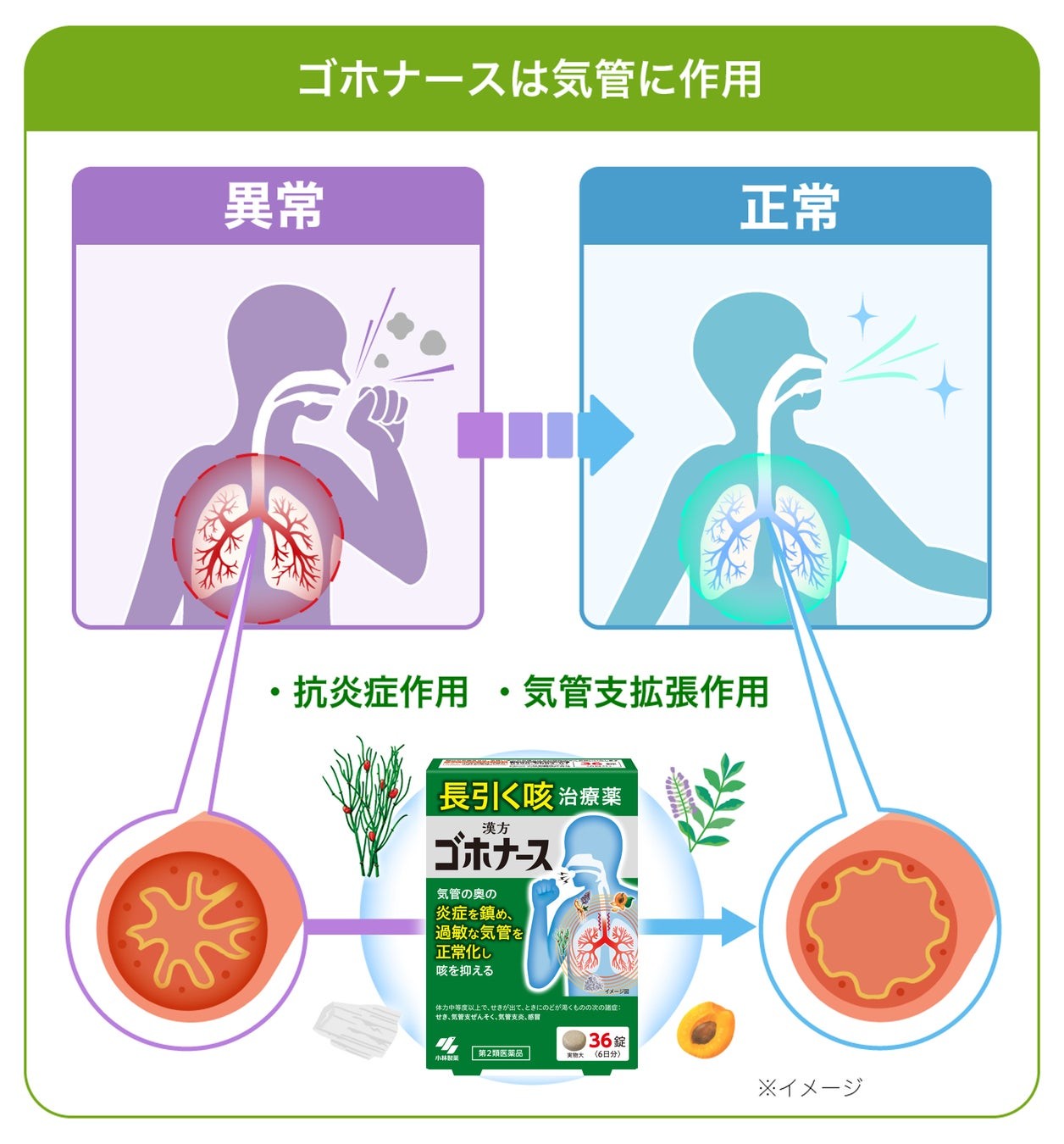 ゴホナースが作用する気管の異常と正常のイメージ図