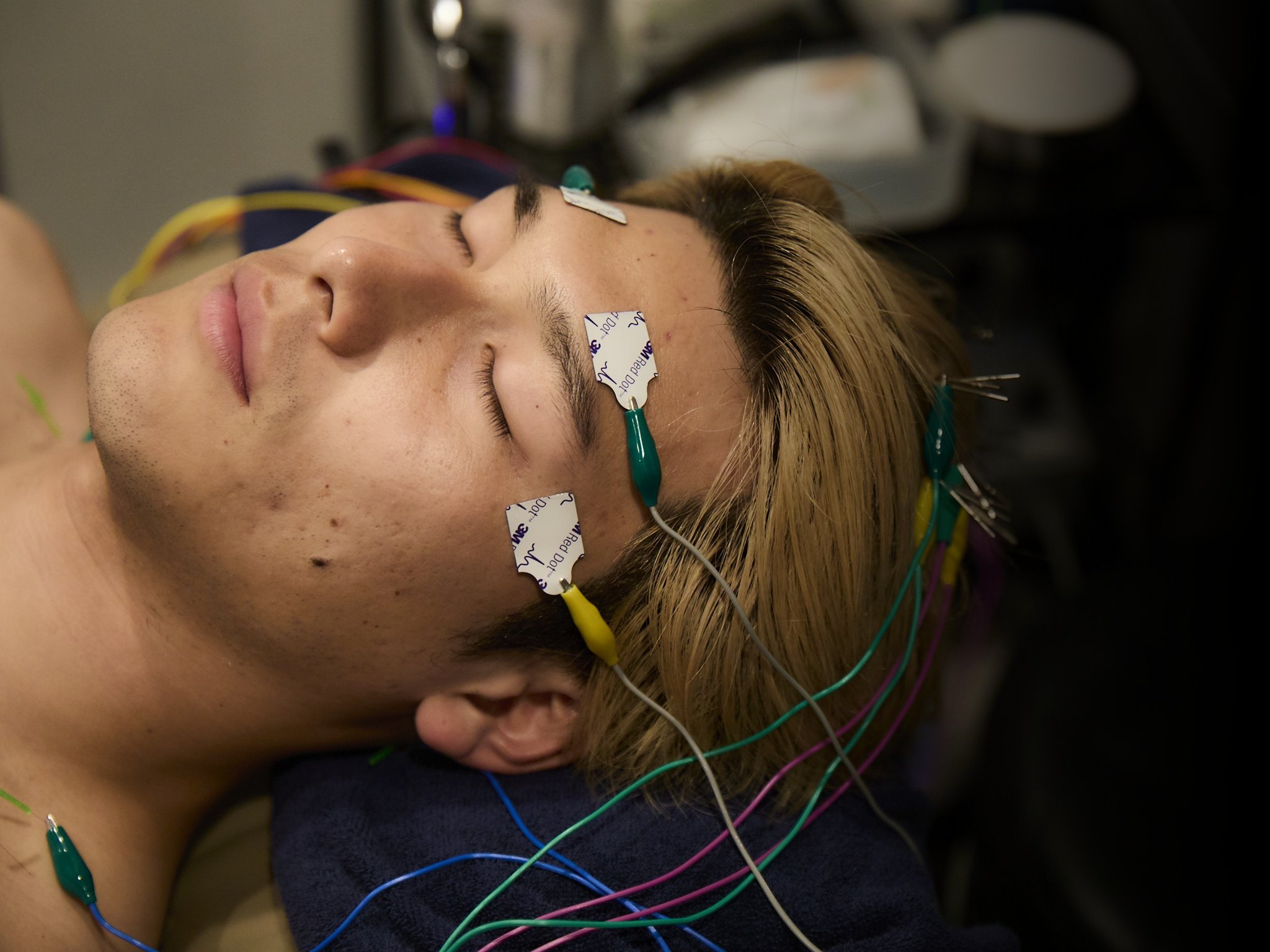 NEL自由が丘院の電極パッドを使った鍼施術