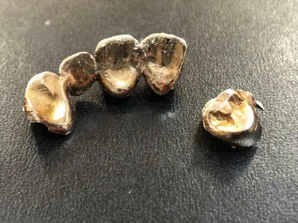金歯の歯型部品